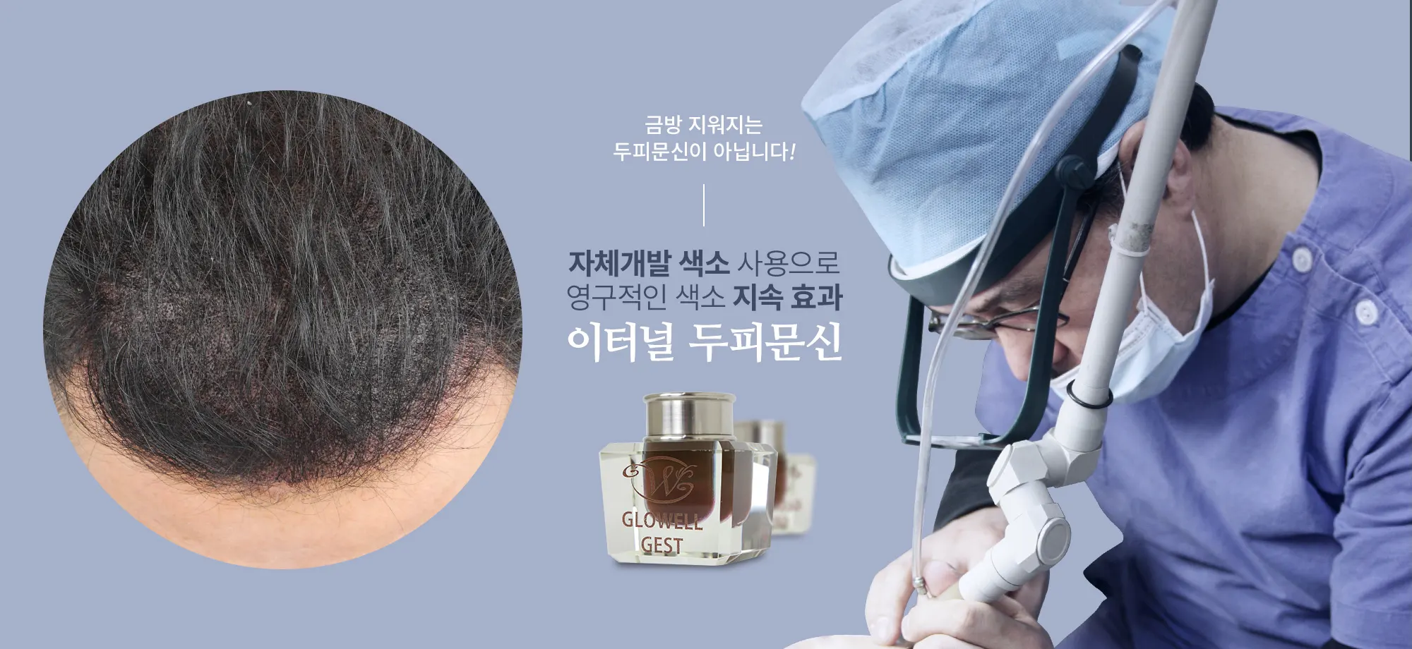 금방 지워지는 두피문신이 아닙니다! 이터널 두피문신