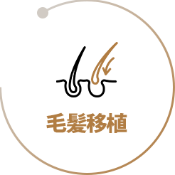 毛髪移植