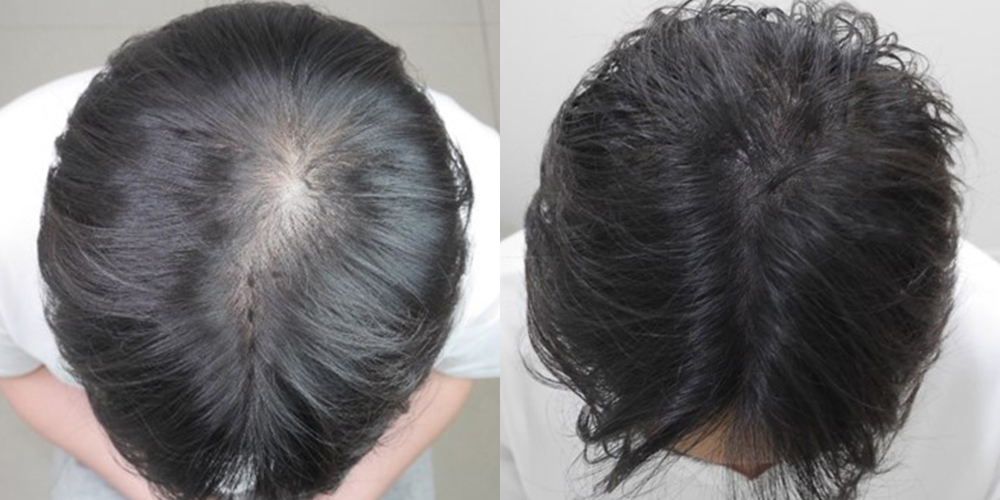 Before-After 비교 2